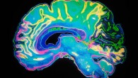 Учёные: во время сна мозг очищается от лишних продуктов обмена веществ
