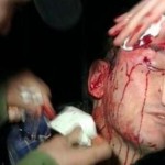Луценко попал в реанимацию после избиения «Беркутом»
